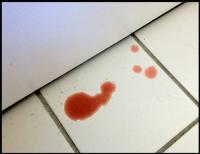 Foto Sangue nelle urine del Gatto: cause e cure