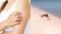 Foto Perchè le zanzare mordono alcune persone rispetto ad altre?